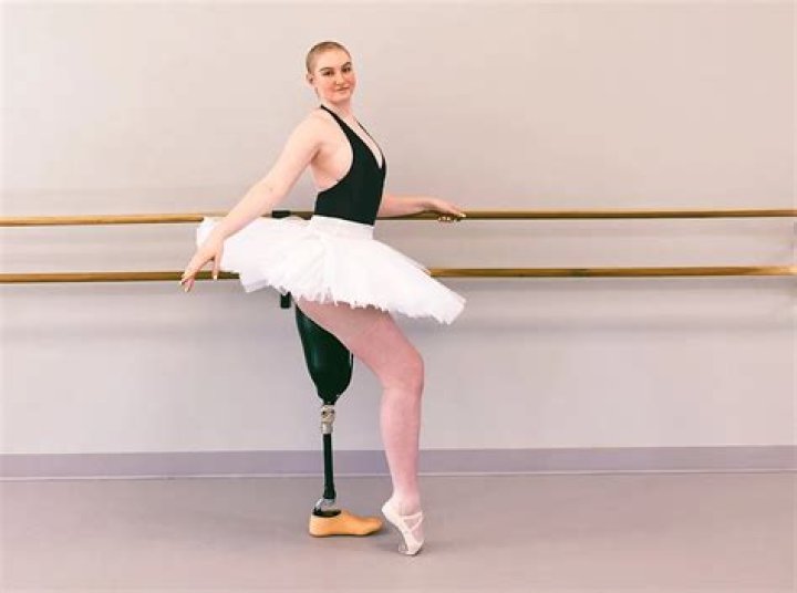 
21-Year-Old Dance Major Continues Ballet Following Bone Cancer, Leg Amputation: ‘I Never Gave Up’ 