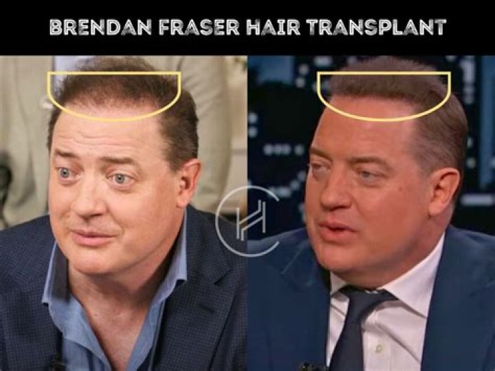 
Brendan Fraser Crying Meme Explained: In Which Scene Did He Cry? 