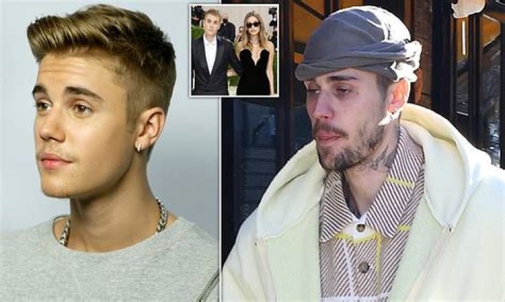 
Did Anne Curtis Rejected Justin Bieber? What Sickness Does He Have? 