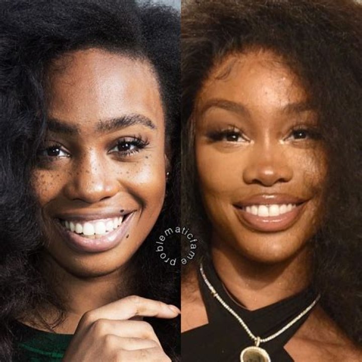 
IG model Sierra Egan’s Wiki: Age, Height, Body Measurements, Before and After Plastic Surgery, Parents 