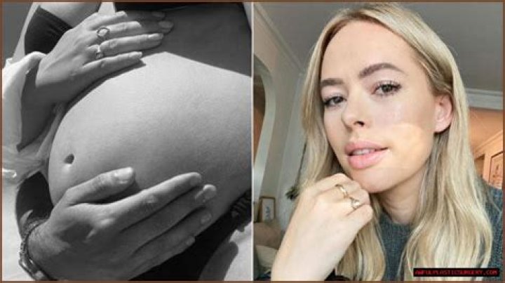 
Tanya Burr New Boyfriend Pregnant, Pregnancy Announcement, Relationship And Boyfriends 