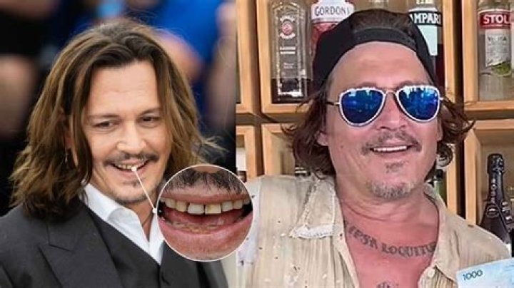 
Who Is Dr David Kulber? Johnny Depp Witness, The Plastic Surgeon’s Testimony 